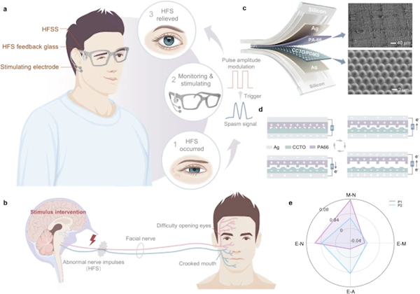 不打针不手术 清华大学发明神奇眼镜 戴上就能治疗面部痉挛